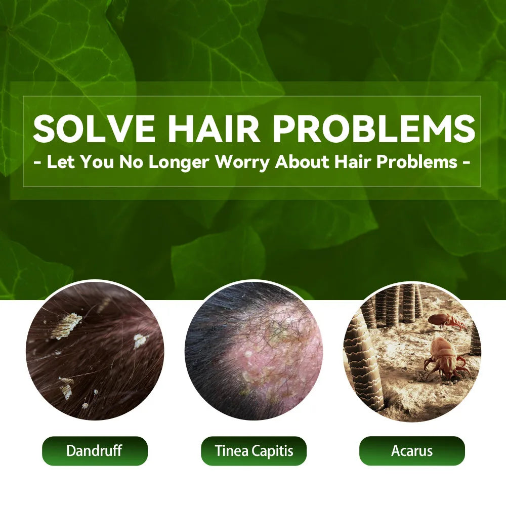 EELHOE Anti It-ching Shampoo Hair Growth Moisturizing Dry Frizzy Repair Damaged Hair Roots Strengthen Cleaning Scalp Treatment