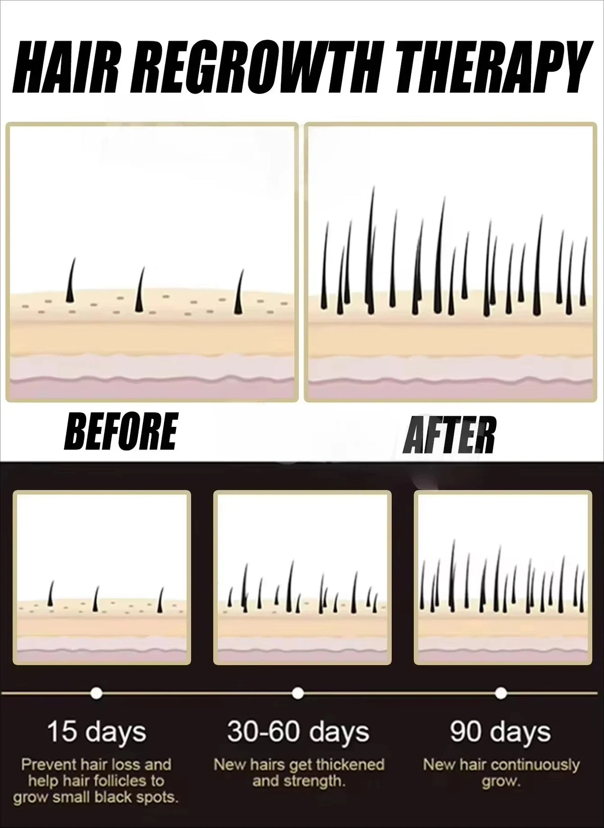 2026 New Hair Care Supplement Support Dense Hair Nourish Scalp Roots Increase Volume For Fuller Shiny Hair In 2 Months