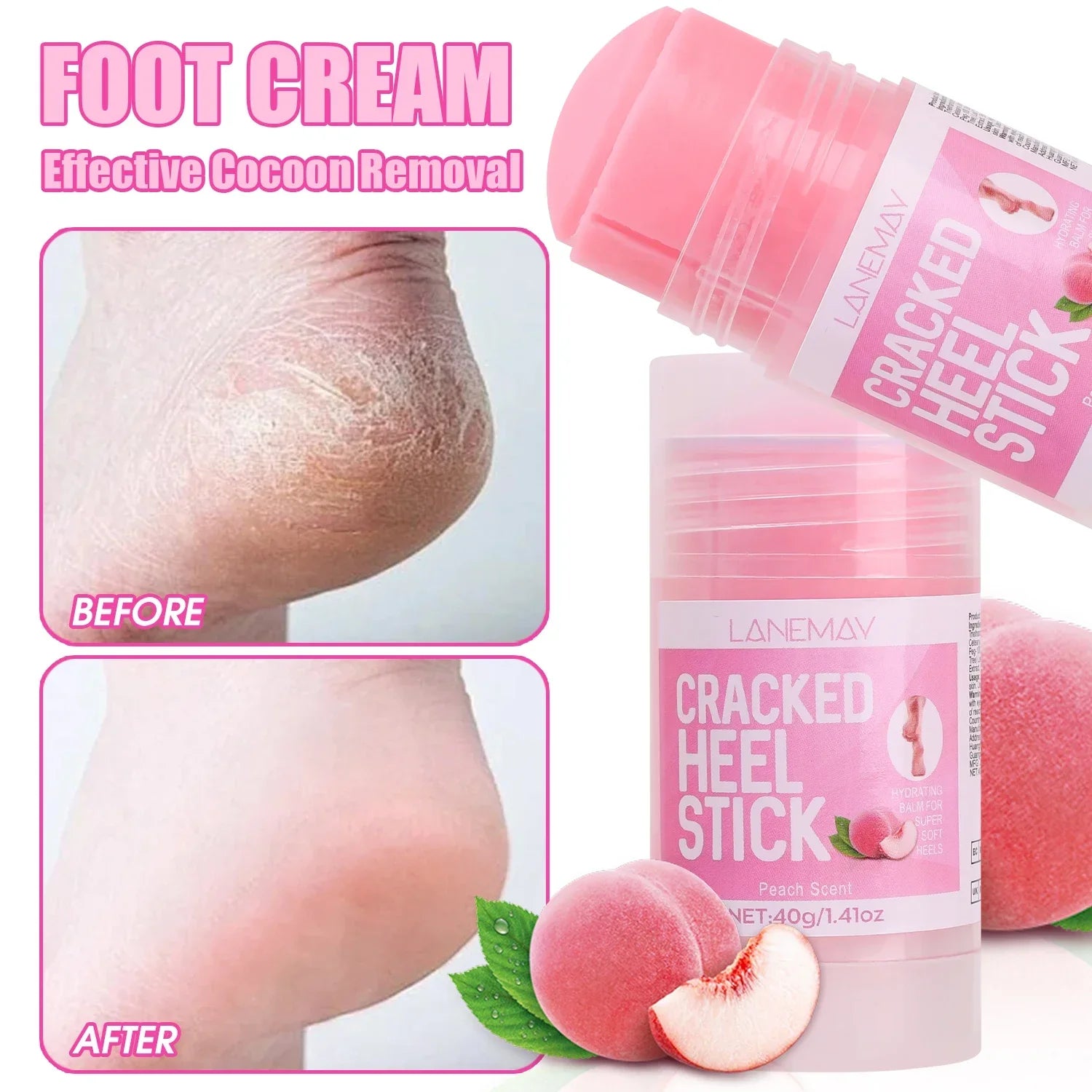 Ultra-Hydrating Foot Care Cream Anti-Drying Crack Removal Dead Moisturizing Skin Hand Feet Care Softening Calluses Cracked Cream