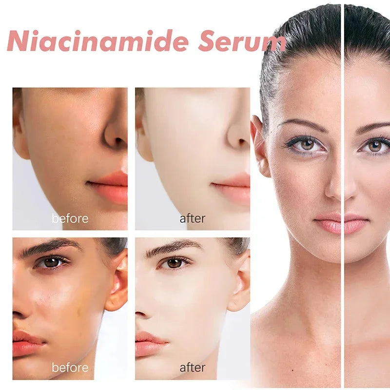 Moisturising Anti-Drying Facial Oil Increase Elasticity Smooth Softening Skin Care Peach 70% Niacinamide Serum 30ml