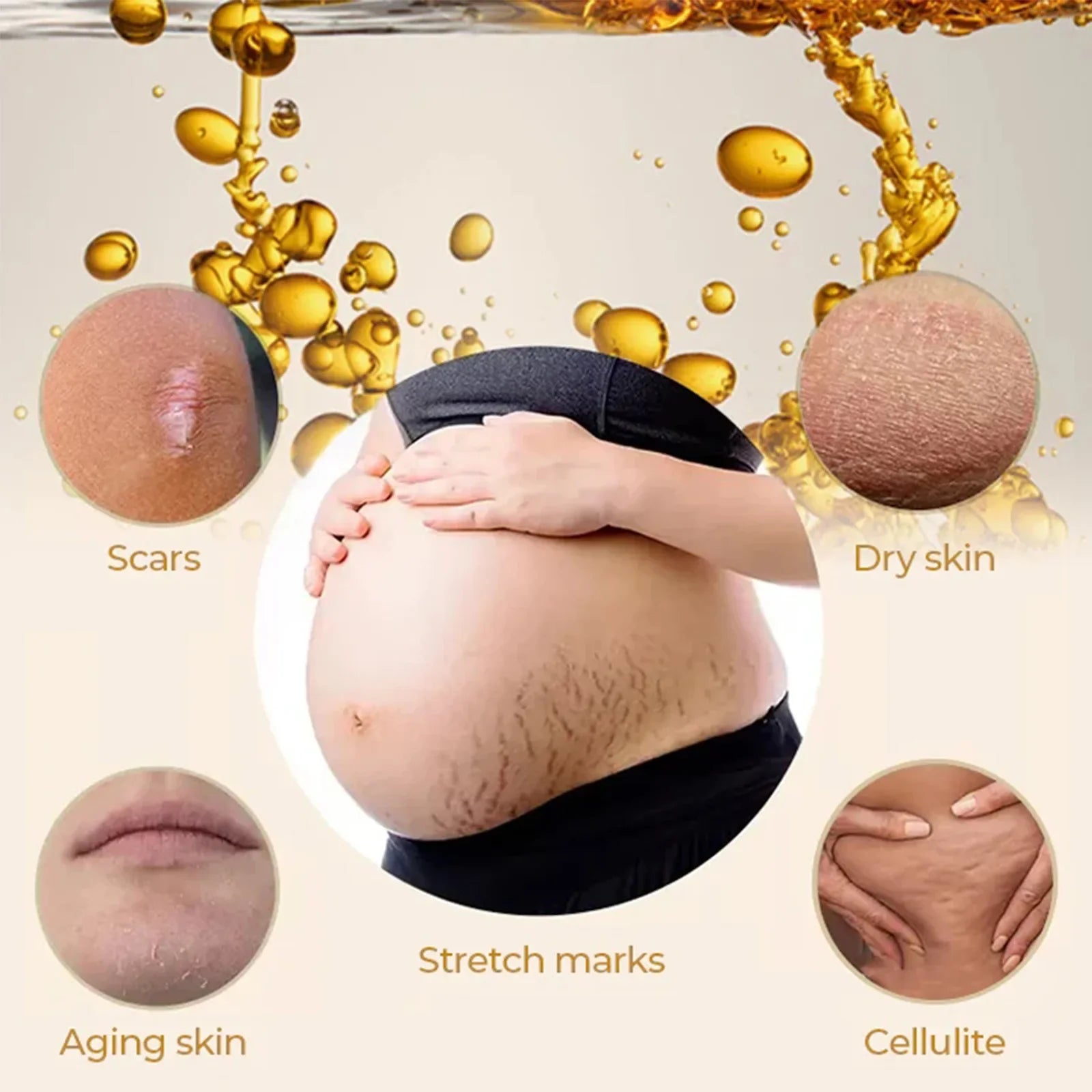 Stretch Mark Removal Oil Moisturize Removes Postpartum Pregnant Women Scar Soothing Nourish Firm Skin Care Olive Essential Oil