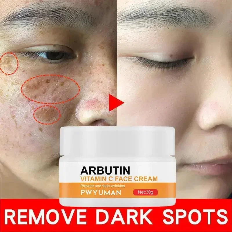 Vitamin C Brightening Freckles Cream Nicotinamide Improve Dark Spot Melanin Moisturizing Nourishing Facial Serum Skin Care