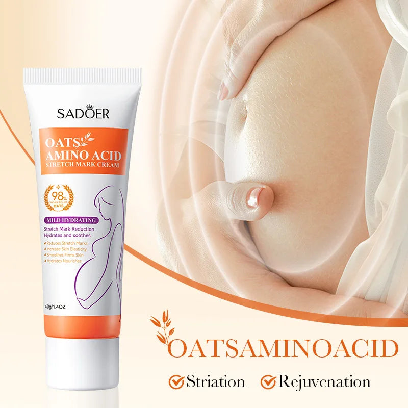 Stretch Marks Body Cream Lightening Stretch Marks Maternity Improves Fine Stretch Mark Soften Moisturizer Firming Body Skin Care