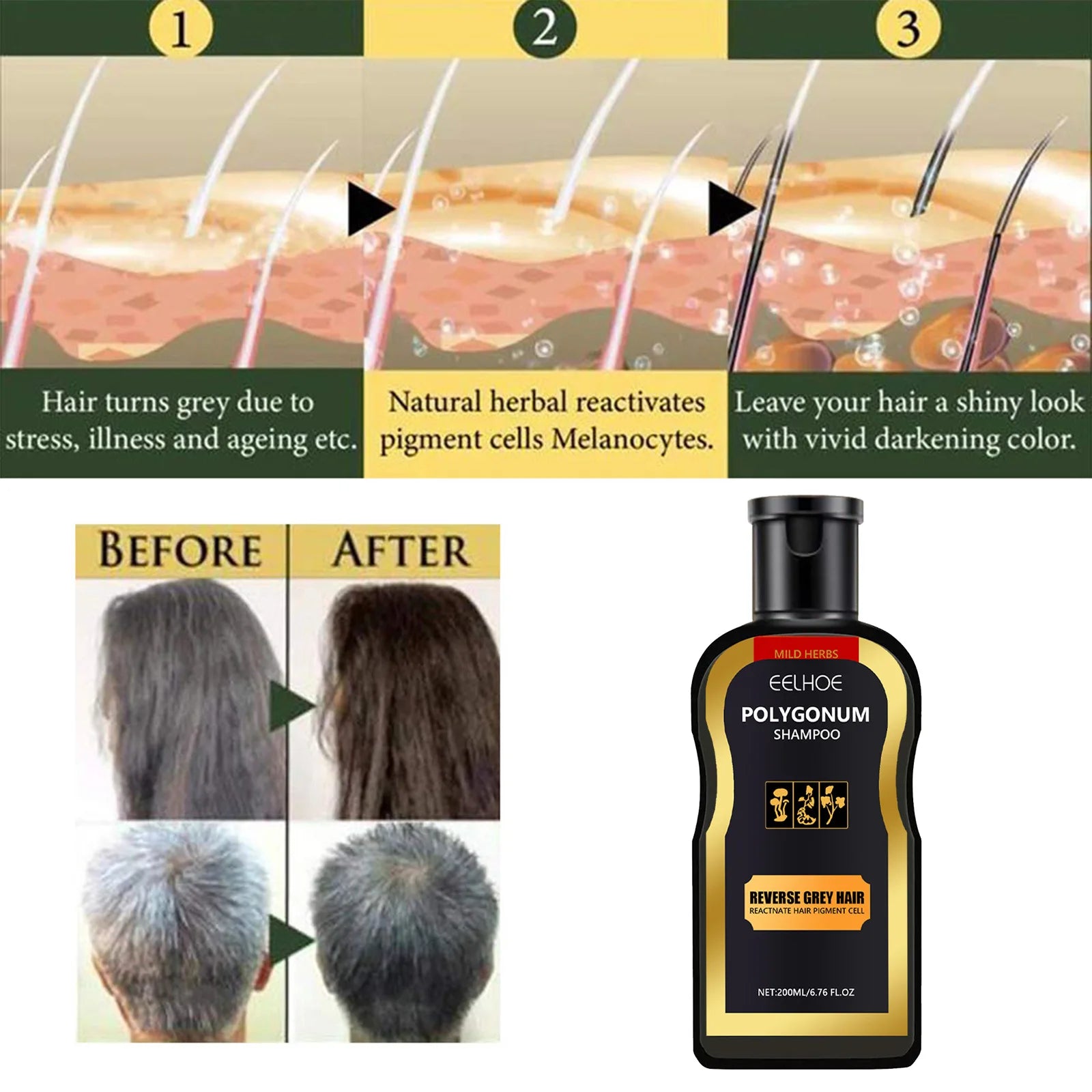 Polygonum Multiflorum Hair Shampoo Cover Gray White To Black Cleaning Dandruff Relief Itch Moisturizing Herbal Darkening Shampoo