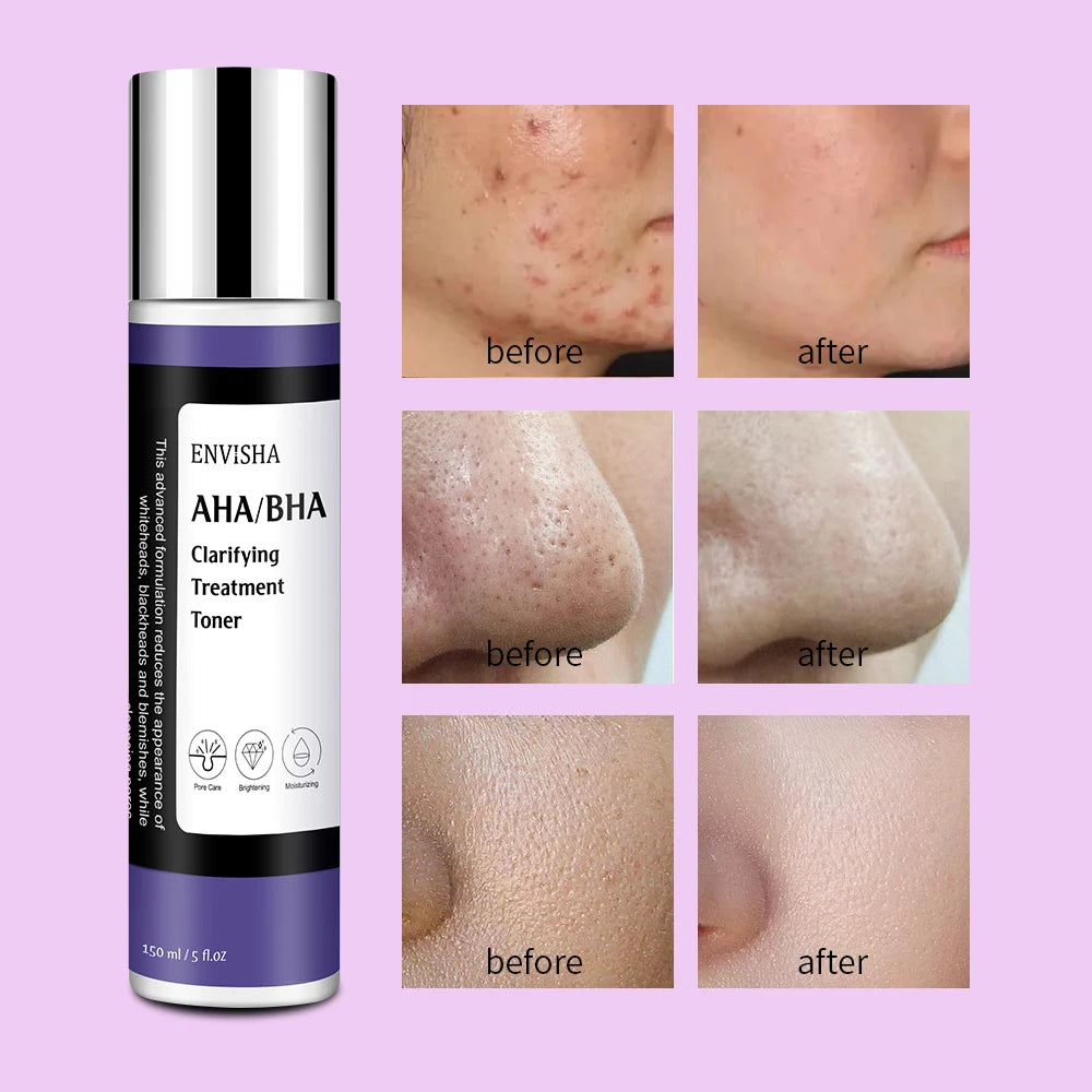 ENVISHA Facial Toner Skin Care Cleansing Shrink Pores Whitening Moisturizing Refreshing Oil Control Anti-acne Anti-Wrinkle Aging