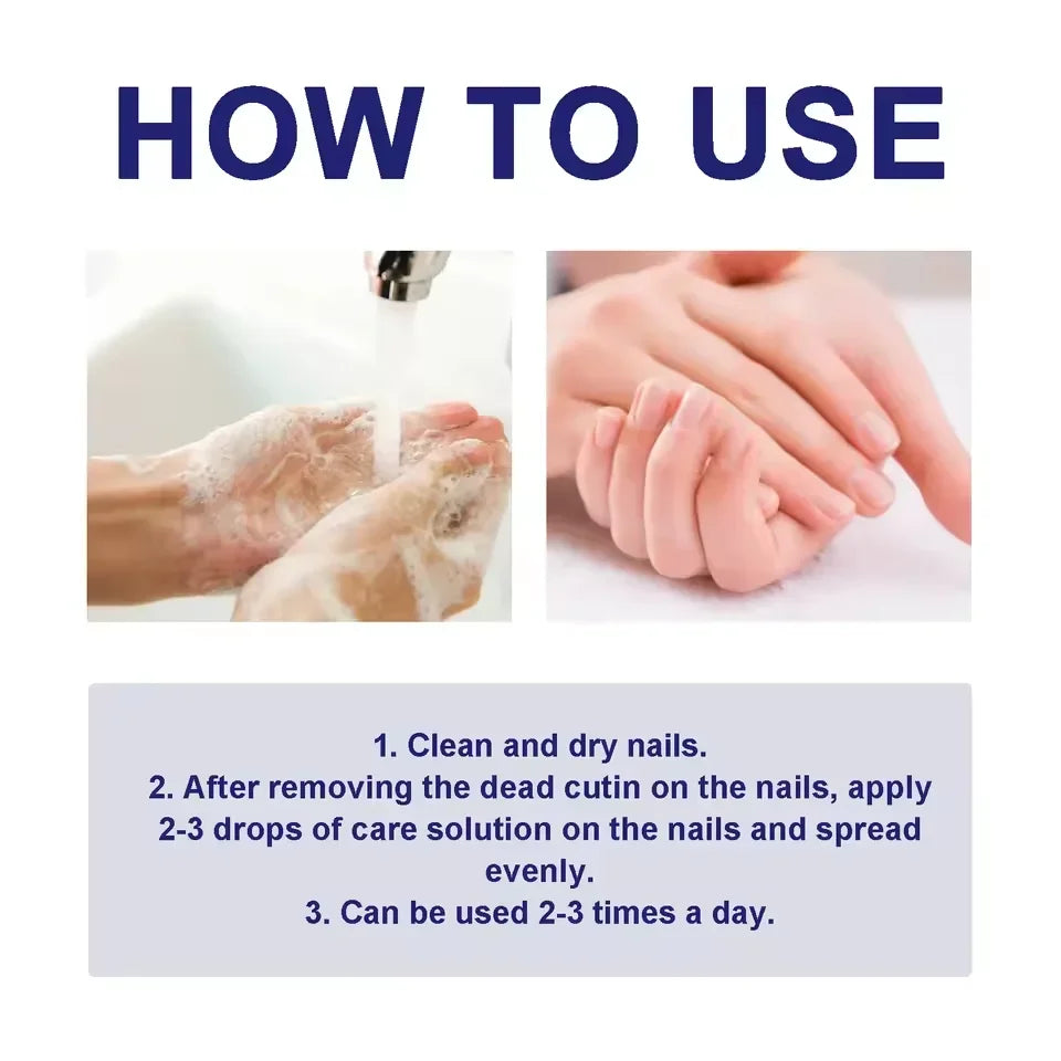 7 DAYS Nail Fungus Treatments Liquid Serum Anti-Infection Onychomycosis Paronychia Hand Care Nails Foot Fungal Removal Gel 10ml