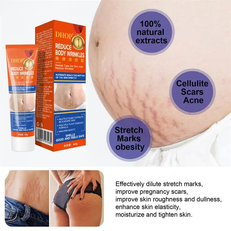 Stretch Marks Permanent Removal Cream Maternity Pregnant Women Pregnancy Anti-Winkle Smooth Repair Firming Skin Body Skin Care
