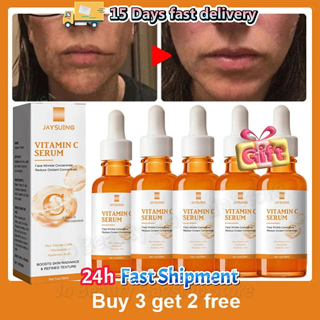 Vitamin C Whitening Serum Face Remove Dark Spots Freckles Fade Melanin Retinol Anti-wrinkle Essence Brightening Korean Skin Care