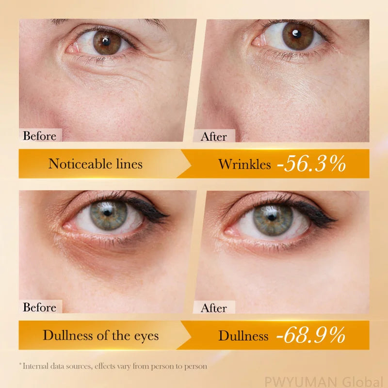 Retinol Anti Wrinkle Eye Serum Peptide Remove Dark Circles Eye Bags Puffiness Cream Moisturizing Repairing Korean Skincare New