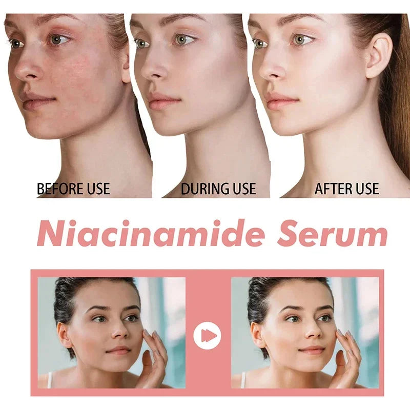 Moisturising Anti-Drying Facial Oil Increase Elasticity Smooth Softening Skin Care Peach 70% Niacinamide Serum 30ml