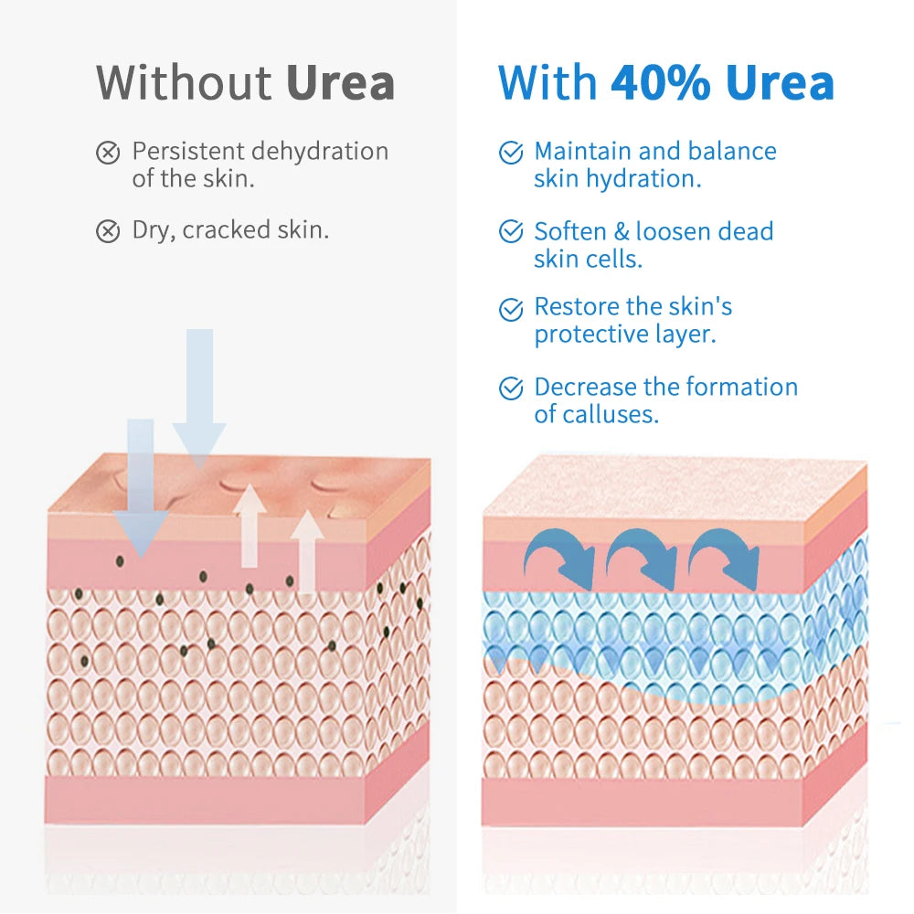New 42% Urea Cream + 2% Salicylic acid Foot and hand Moisturizer, deep moisturizer and Nourishing moisturizer
