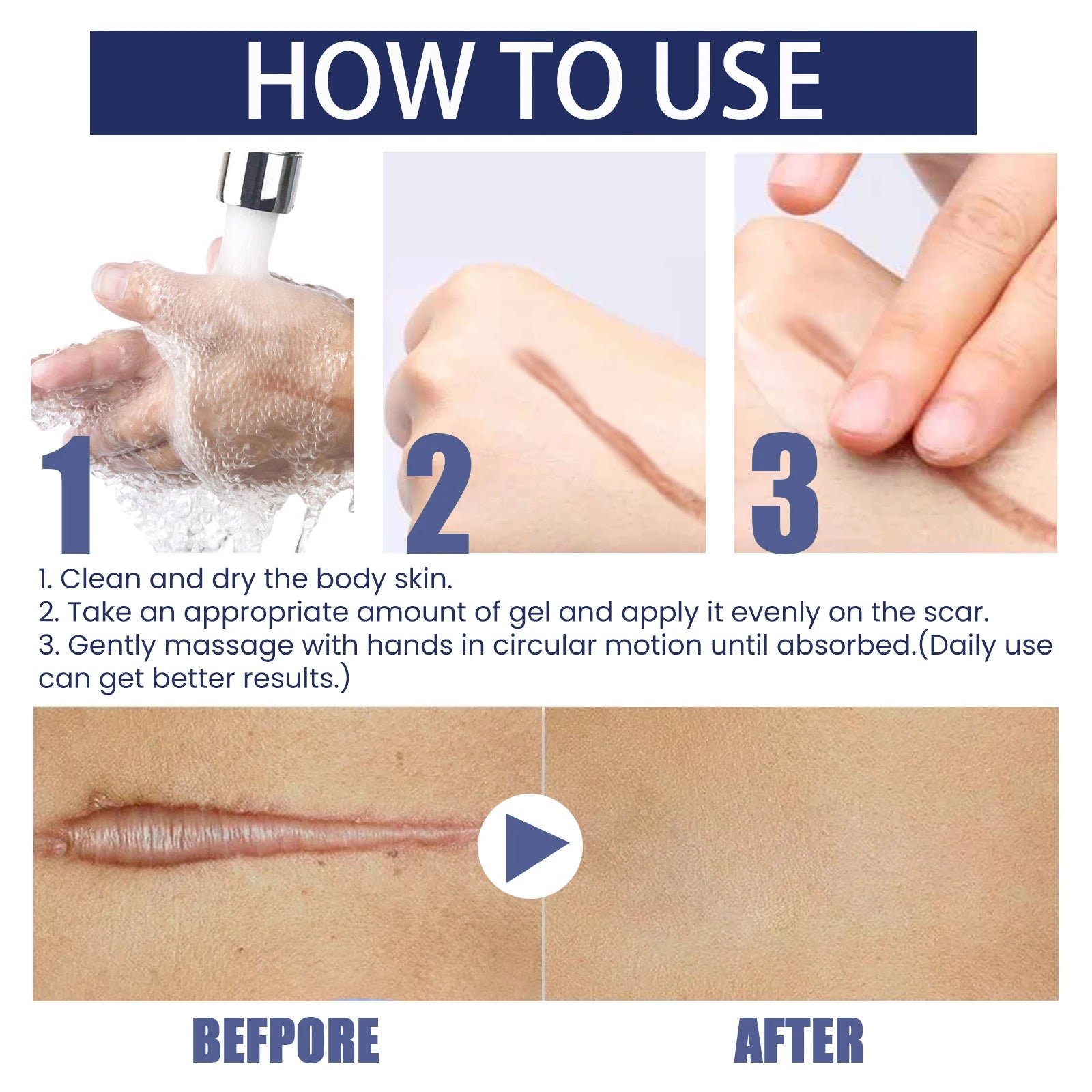 EELHOE Silicone Skin Scar Gel Retinol Niacinamide Scars Stretch Marks Burn Marks Deeply Nourish Skin Reduce Redness Swelling 30g