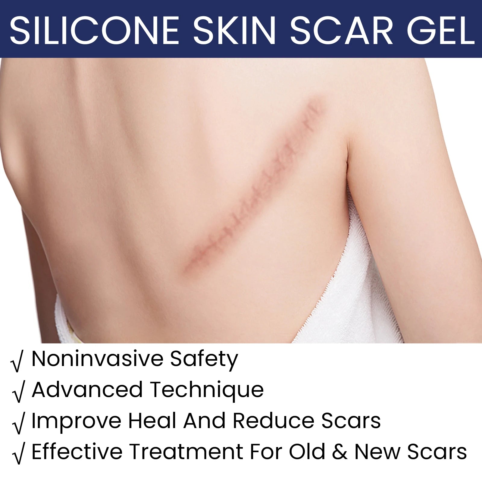 EELHOE Silicone Skin Scar Gel Retinol Niacinamide Scars Stretch Marks Burn Marks Deeply Nourish Skin Reduce Redness Swelling 30g