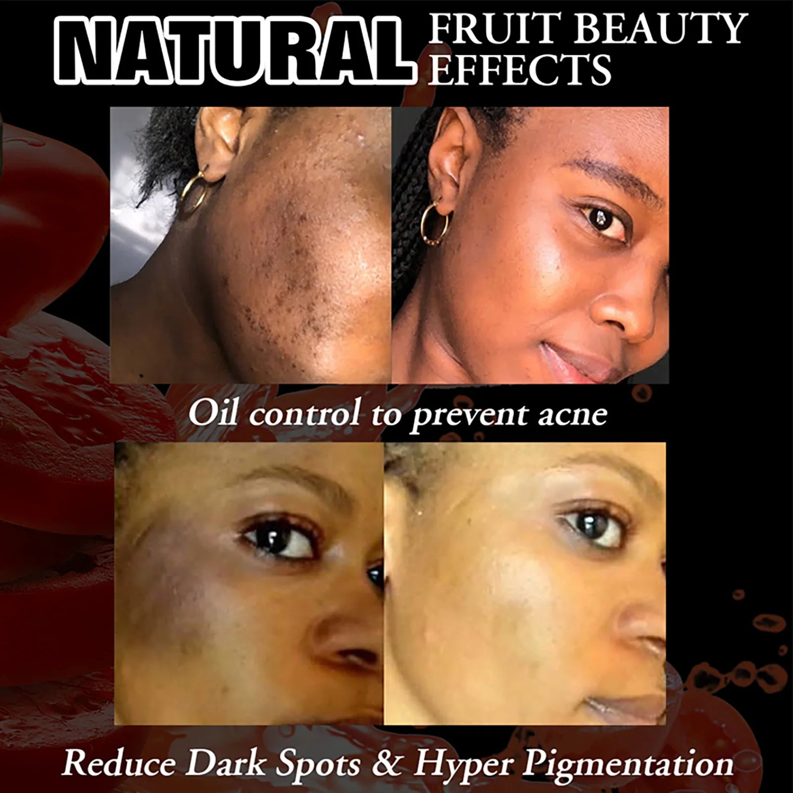 AILKE Natural Tomato Soap Bar, Whitening, Clean and Smooth Skin, Remove Wrinkles, Pigmentation, Acne, For All Skin Types, 200g