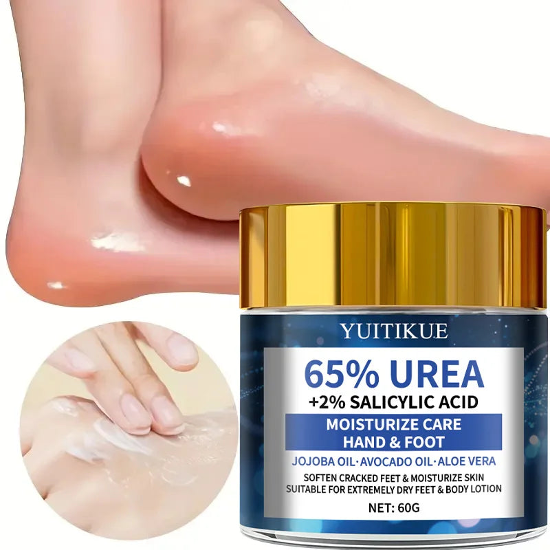YUITIKUE 65% Urea Foot Cream 60g - Soften Cracked Heels in 2 Weeks, Fast Absorption Non-Greasy, with Jojoba & Avocado Oils