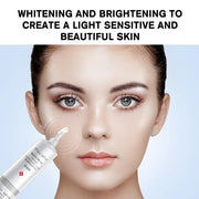 Whitening Cream Anti Freckle Face Cream Remove The Black Melasma Dark Spot Acne Deposits On The Skin Brighten Skin Care؜