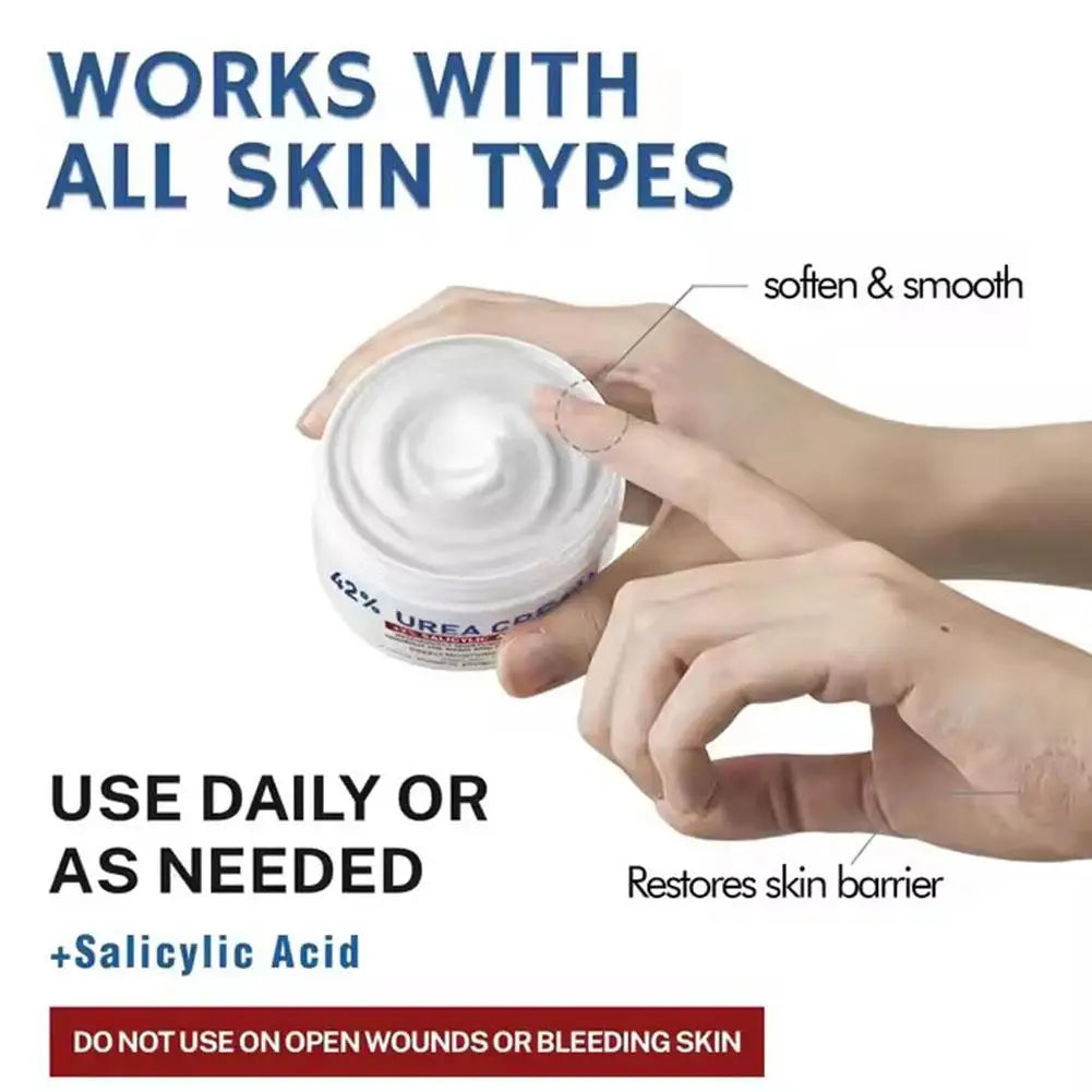 40% Urea Cream Anti-dry Cracking Moisturizing Hydration Hand and Foot Cream Vitamin E Anti-drying Relieving Itching Body Lotion