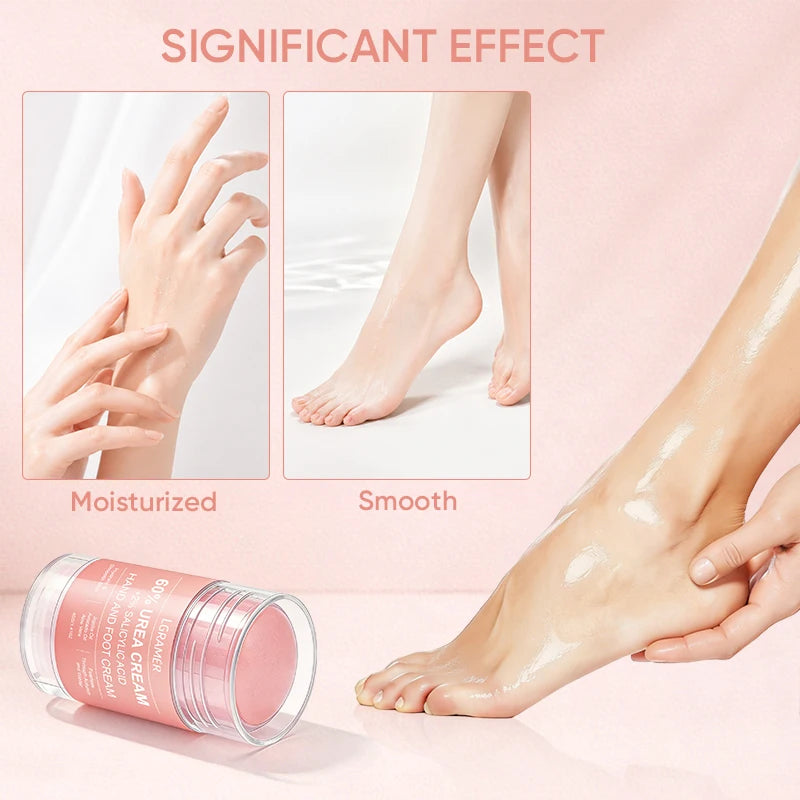 Urea Cream 60 Percent For Feet + 2% Salicylic Acid Exfoliation Foot Cream and Hand Cream Maximum Strength with Hyaluronic Acid