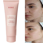 Revitalize Skin Fruit Acid Peeling Gel Facial Cleansing Exfoliating Peeling Scrub Deep Clean Acne Blackhead Remove Face Cleanser