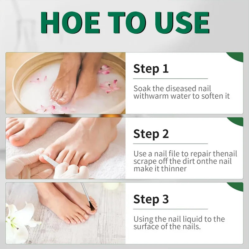 Fungal Nail Treatment Serum 7 Days Fungus Removal Treating Paronychia Liquid Anti Gray Nails Infection Foot Repair Care Tools