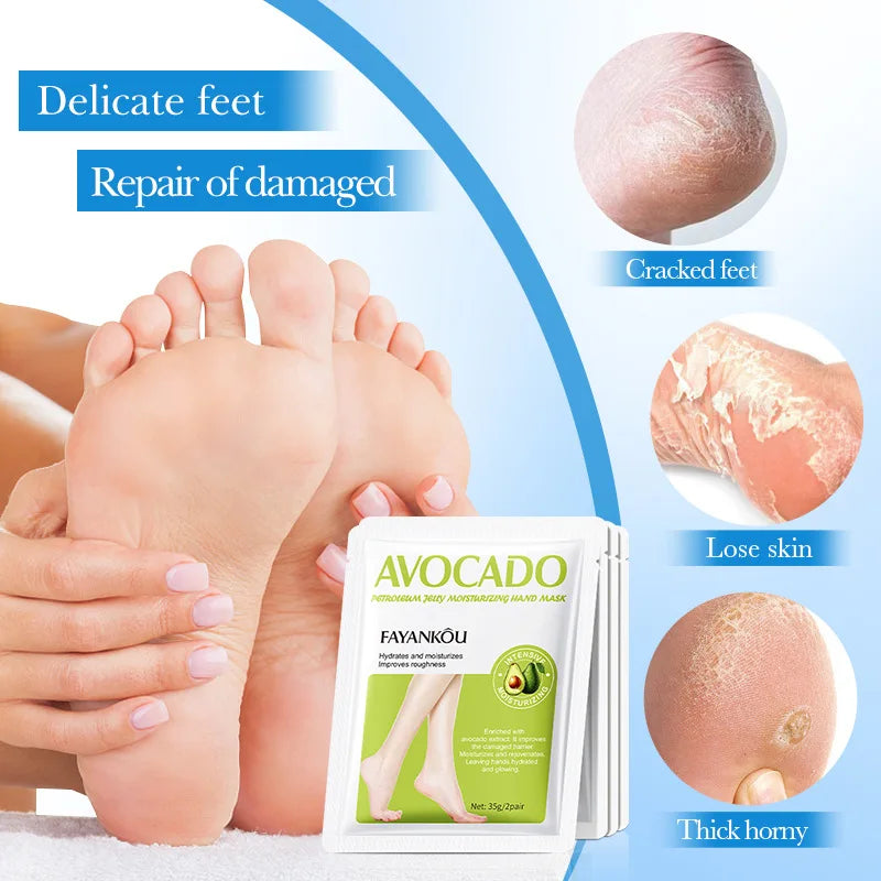 5 Pairs Avocado Exfoliating Foot Mask Feet Pedicure Remove Dead Skin Moisturizing Foot Exfoliator Feet Masks Skin Care Products