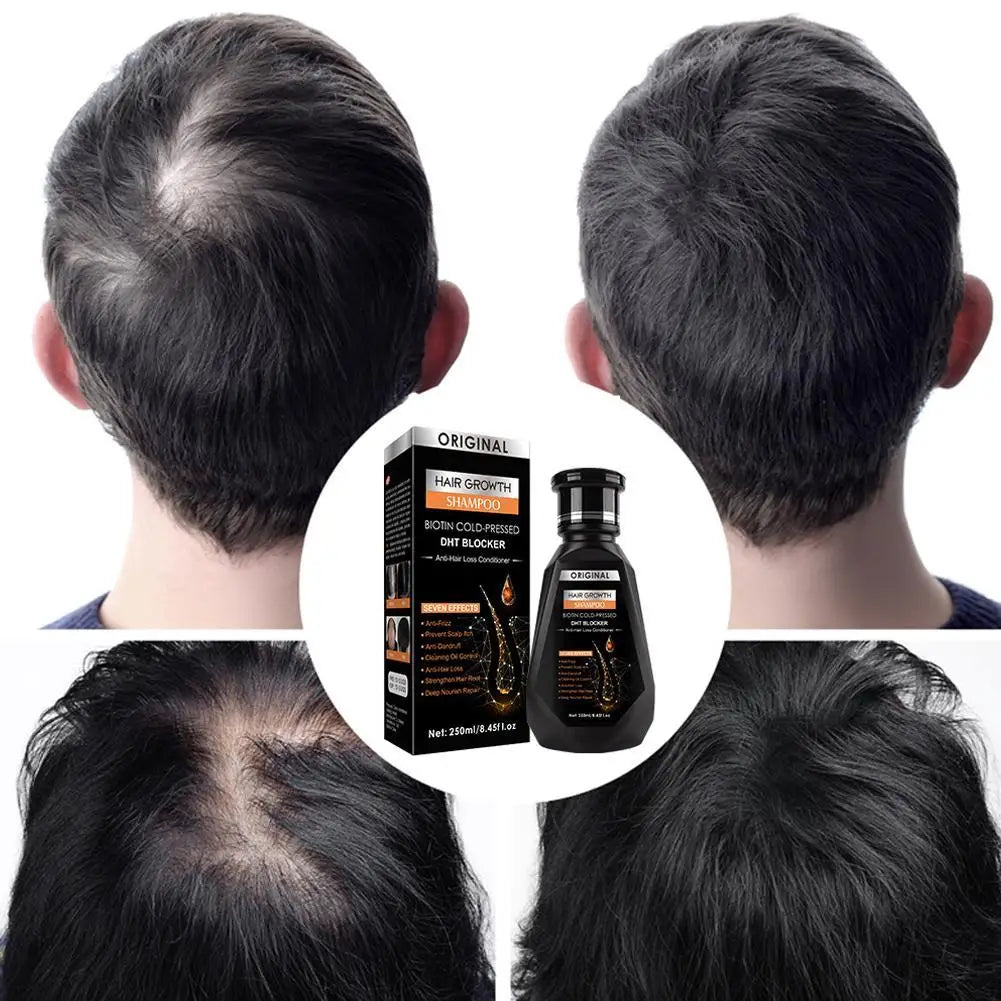1/2/3Pcs Hair Growth Shampoo, Ginger Shampoo Deep Cleaning Nourish Scalp Deep Cleaning Nourish Scalp Enhance Hair Elasticity