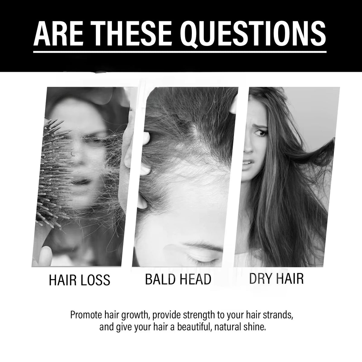2026 New Hair Care Supplement Support Dense Hair Nourish Scalp Roots Increase Volume For Fuller Shiny Hair In 2 Months