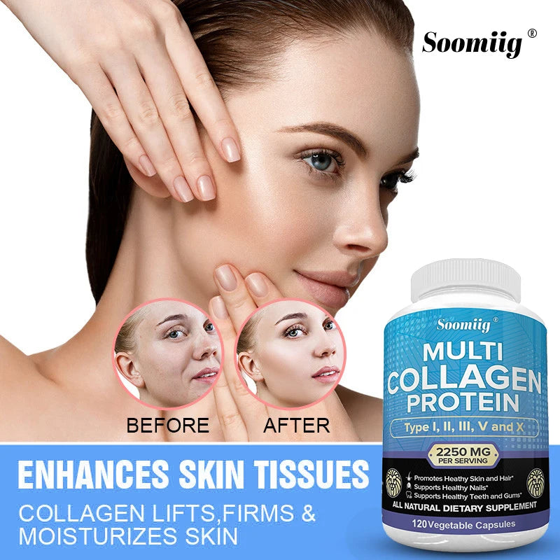 Collagen Peptides Capsules - Multi-Collagen Protein - for Hair Skin Nails Teeth Gums Joints, Gluten Free, Non-GMO