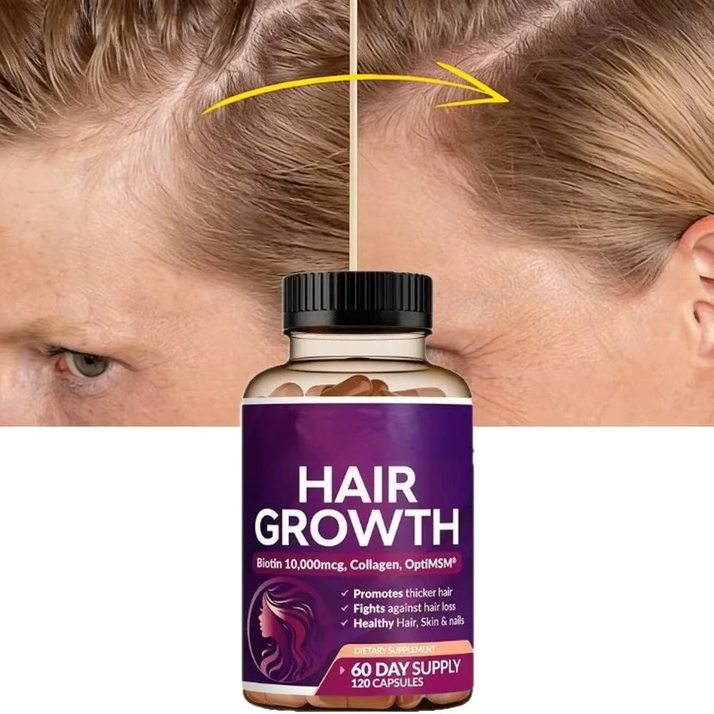 2026 New Hair Care Supplement Support Dense Hair Nourish Scalp Roots Increase Volume For Fuller Shiny Hair In 2 Months