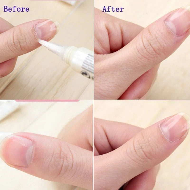 1pcs Cuticle Oil Pen Nail Nutrition Oil Pen Nail Treatment Cuticle Revitalizer Oil Prevent Agnail Nail Polish Nourish Skin Care