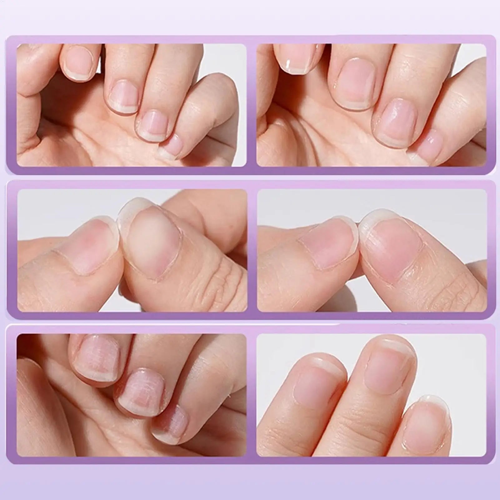 3in-1 Cuticle Oil Pen Nail Strengthener Damaged Nail Care Chip-resistant Dead Skin Cuticle Remover Pen For Nourishing Split