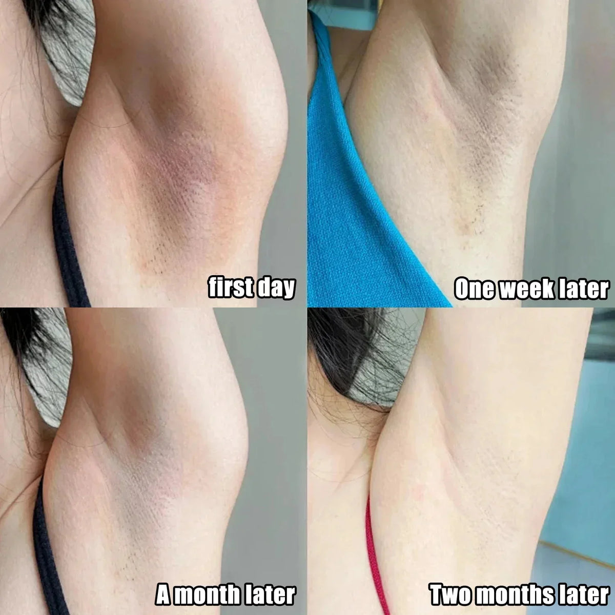 Whitening Cream Private Parts Underarm Bleaching Serum Whiten Butt Knee Brighten Inner Thigh Intimate Parts Dark Remove Melanin