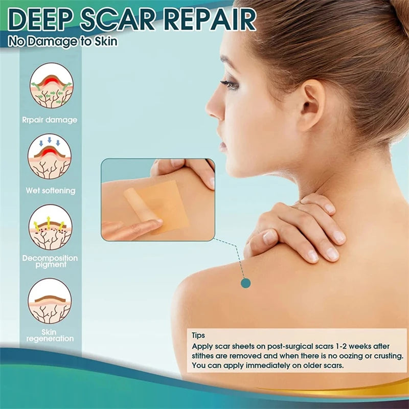 1 Roll Silicone Scar Sheets , Self-Adhesive Scar Cover Tape Reusable and Effective Skin Care Strips