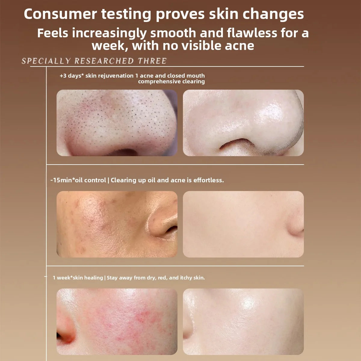 RUYI Fruit Acid Essence Toner Shrinks Pores Acid Removal Brighten Moisturizing & Repairing Control Oil Soothing Redness Winter