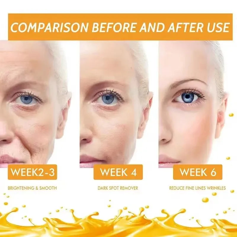 Vitamin C Whitening Serum Face Remove Dark Spots Freckles Fade Melanin Retinol Anti-wrinkle Essence Brightening Korean Skin Care