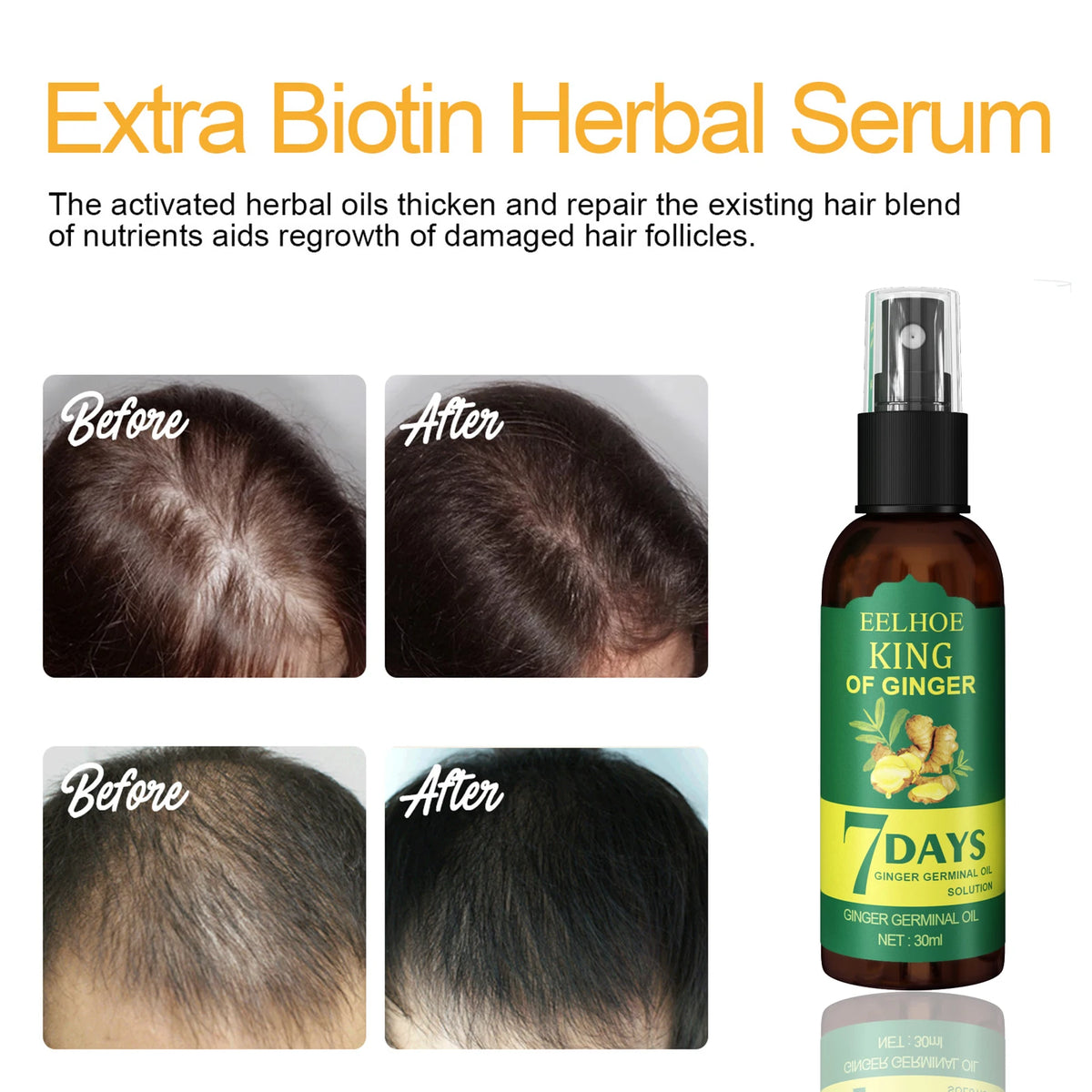 Ginger Oil Hair Booster Serum Spray Nourish Scalp Hair Follicles Refresh Control Oil Strengthen Hair Roots Nutrient Solution