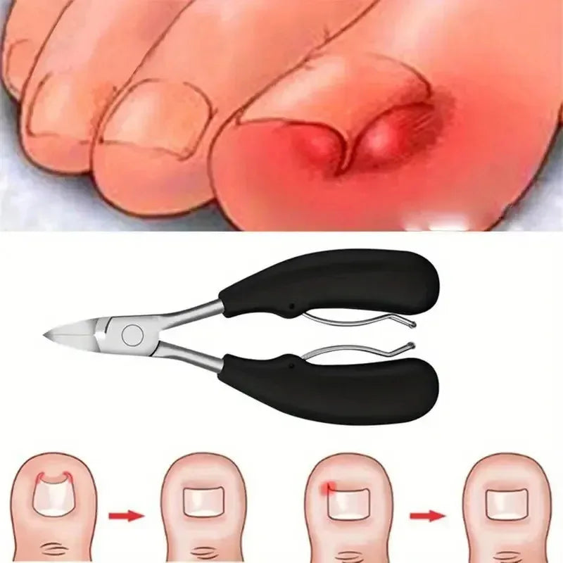 Ingrown Toenail Thick Nail Clipper Set Heavy-Duty Podiatrist Grade Nail Cutter Dead Skin Remover Manicure Pedicure Nail Tools