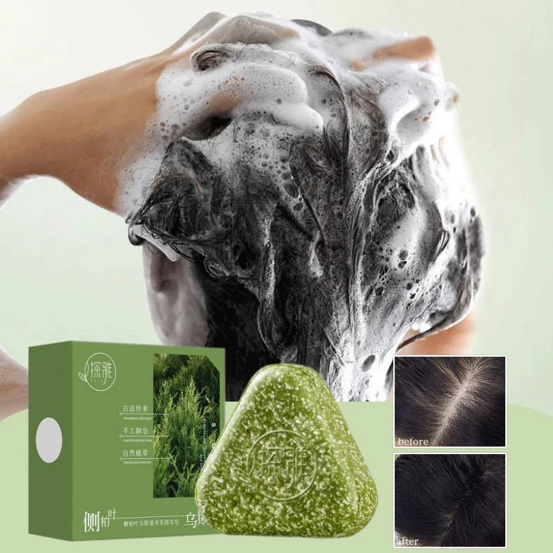 Herbal Handmade Shampoo Soap Arborvitae Usman Grass Anti-hair Loss Oil Control Dandruff Itching Herbal Fluffy Hair Follicle Soap