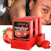AILKE Natural Tomato Soap Bar, Whitening, Clean and Smooth Skin, Remove Wrinkles, Pigmentation, Acne, For All Skin Types, 200g
