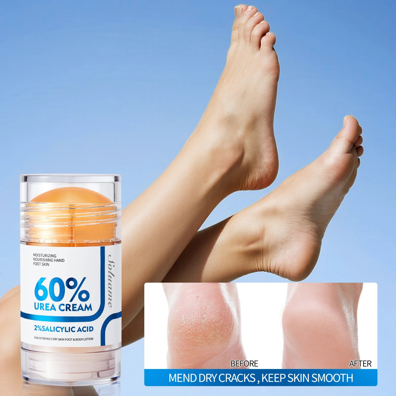 Two-Piece Set Includes 60% Urea Hydrating Foot Cream and Body Cream for Dry Cracked Hands and Heels with 2% Salicylic Acid Foot Care