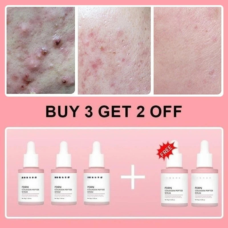 Collagen Peptide Facial Serum for Dull Skin Boosts Elasticity Skin Renewal Repair Salmon PDRN Korean Beauty Product