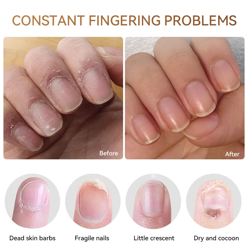 LILYCUTE 5ml Nail Cuticle Nutrient Oil Restore Damaged Nails Softener Nourishing Treatment Skin Revitalizer Remedy Manicure