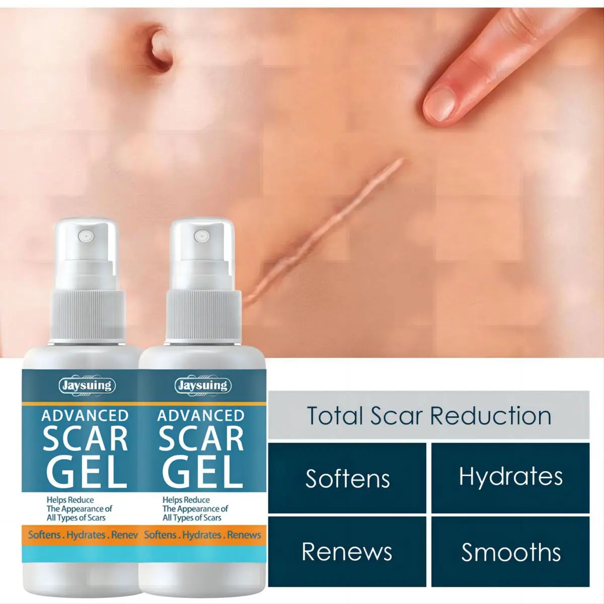 Jaysuing Fade Scar Cream Gel Skin Scar Repair Cream Postpartum Stretch Mark Scar Surgery Smooths Skin