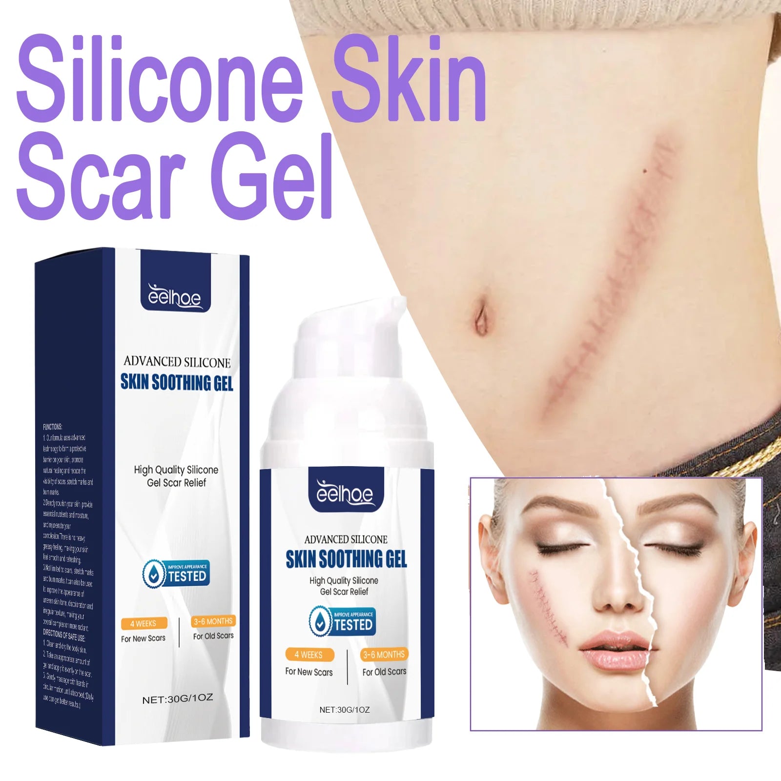 EELHOE Silicone Skin Scar Gel Retinol Niacinamide Scars Stretch Marks Burn Marks Deeply Nourish Skin Reduce Redness Swelling 30g