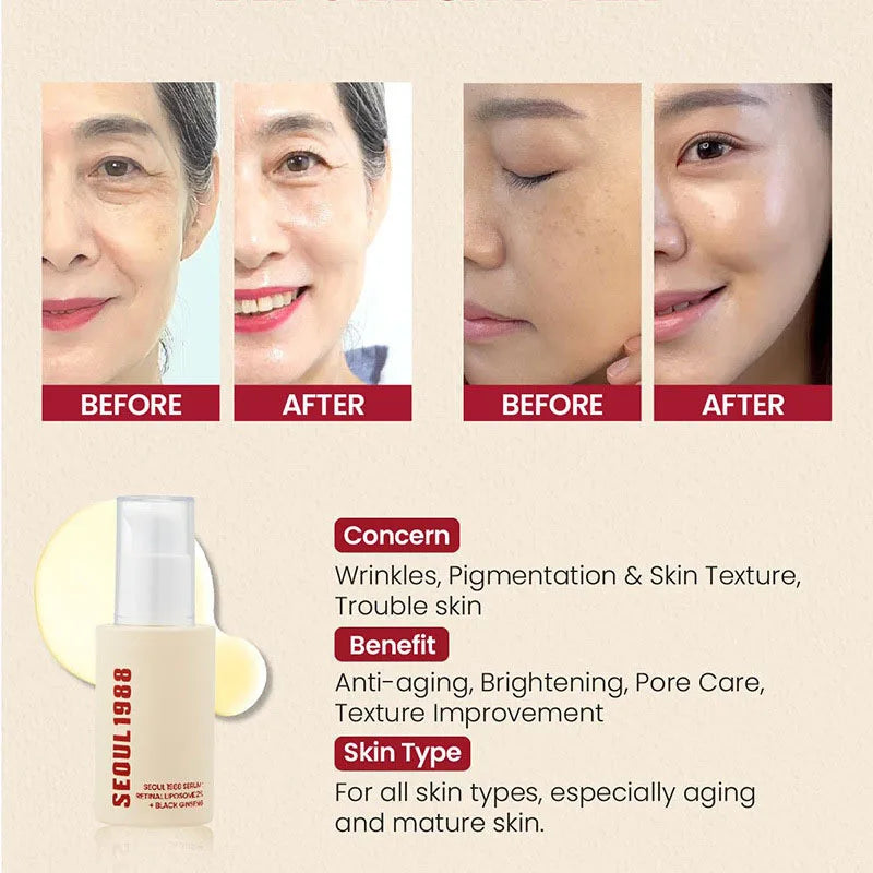 1/2/3PCS Korean SEOUL 1988 Retinol Face Serum Fade Fine Wrinkle Moisturizing Whitening Remove Spot Shrink Pores Beauty Skin Care