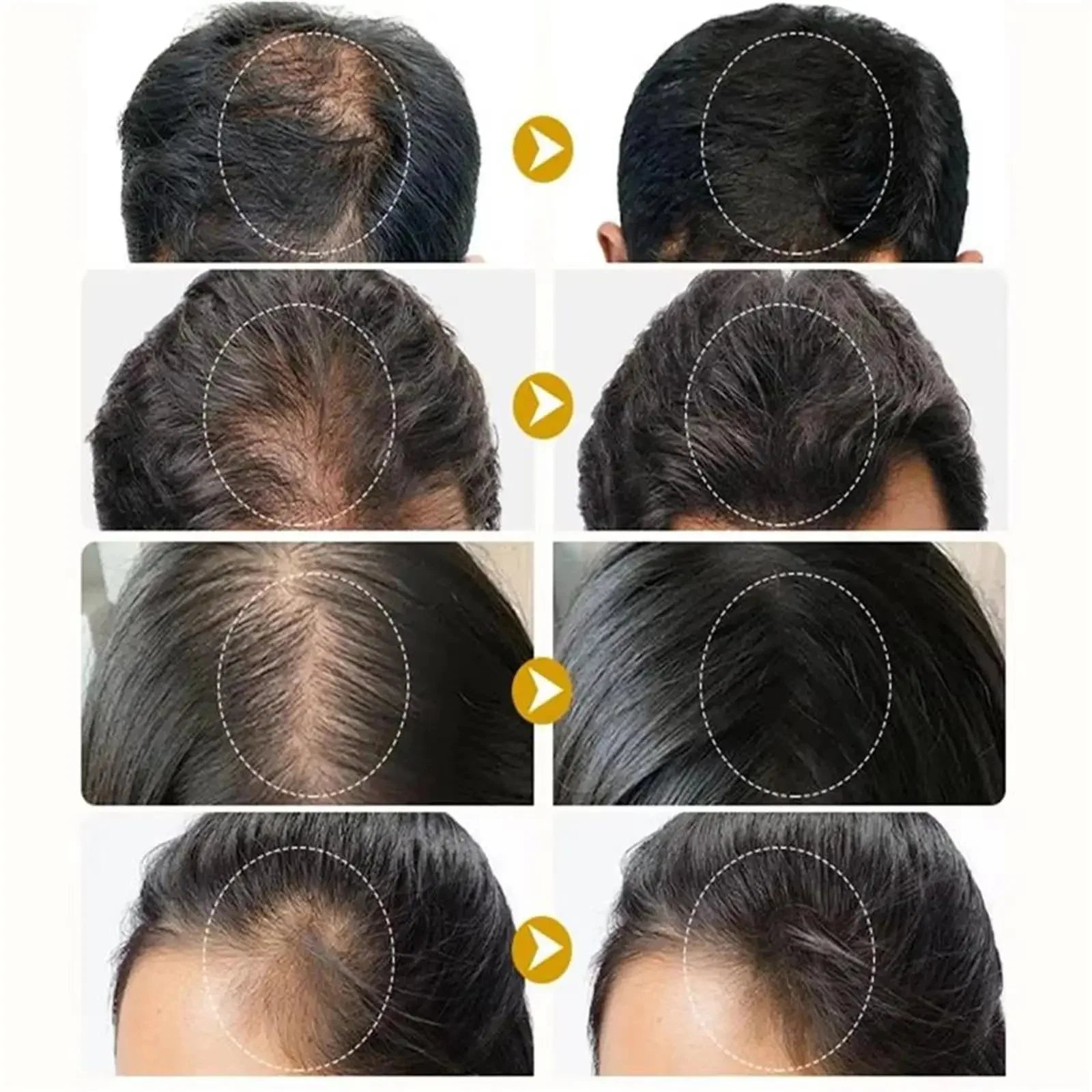 Hair Growth Serum Anti Loss Regrowth Hair Growth Oil Prevent Baldness Repair Damage Scalp Massage Moisturizing Nourish Hair Care