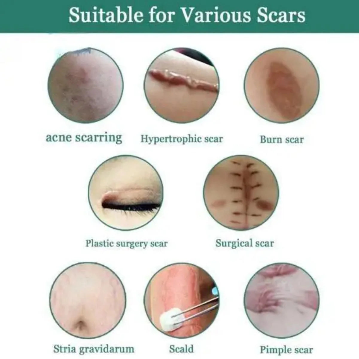 Jaysuing Fade Scar Cream Gel Skin Scar Repair Cream Postpartum Stretch Mark Scar Surgery Smooths Skin