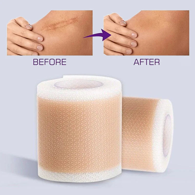 1 Roll Silicone Scar Sheets , Self-Adhesive Scar Cover Tape Reusable and Effective Skin Care Strips