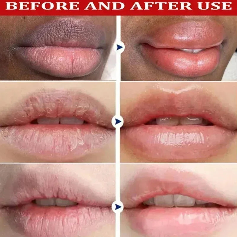 Deep Moisturizing Lip Balm Remove Dark Lighten Melanin Mask Exfoliate Dead Skin Fade Lip Line Hydration Brighten Repair Lips