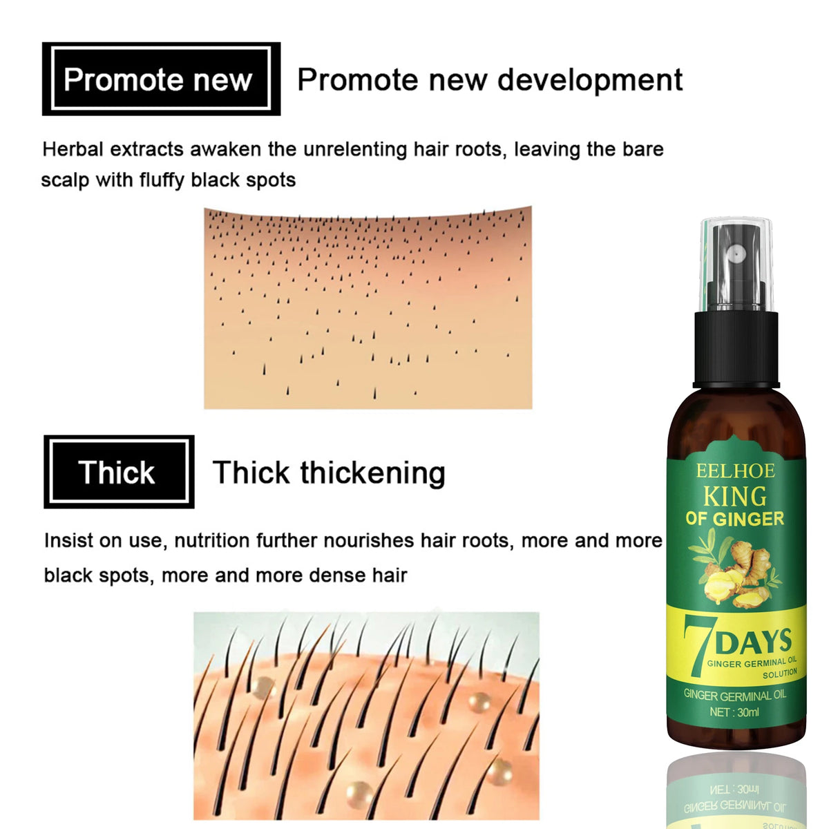Ginger Oil Hair Booster Serum Spray Nourish Scalp Hair Follicles Refresh Control Oil Strengthen Hair Roots Nutrient Solution